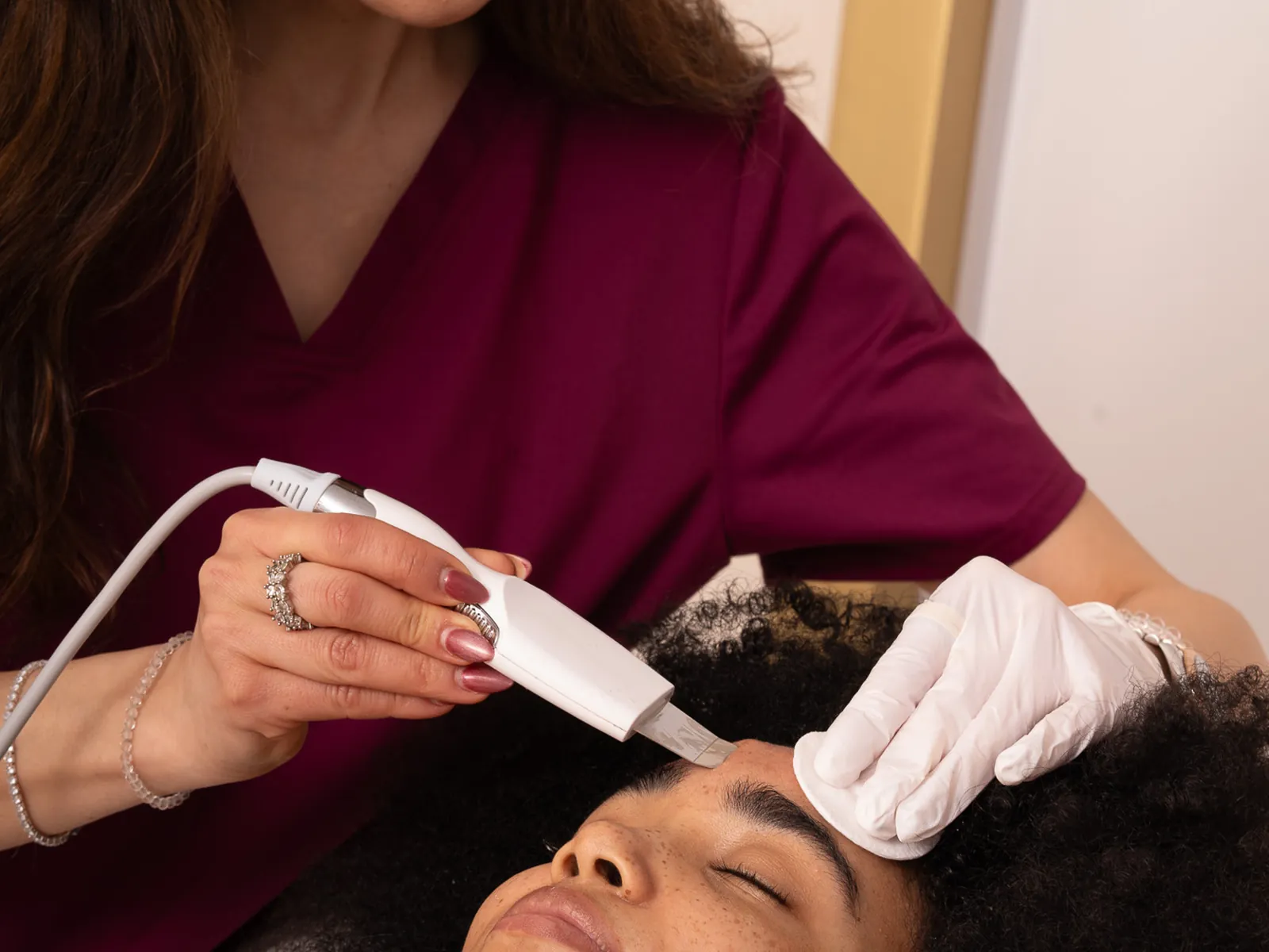Hollywood Peel treatment