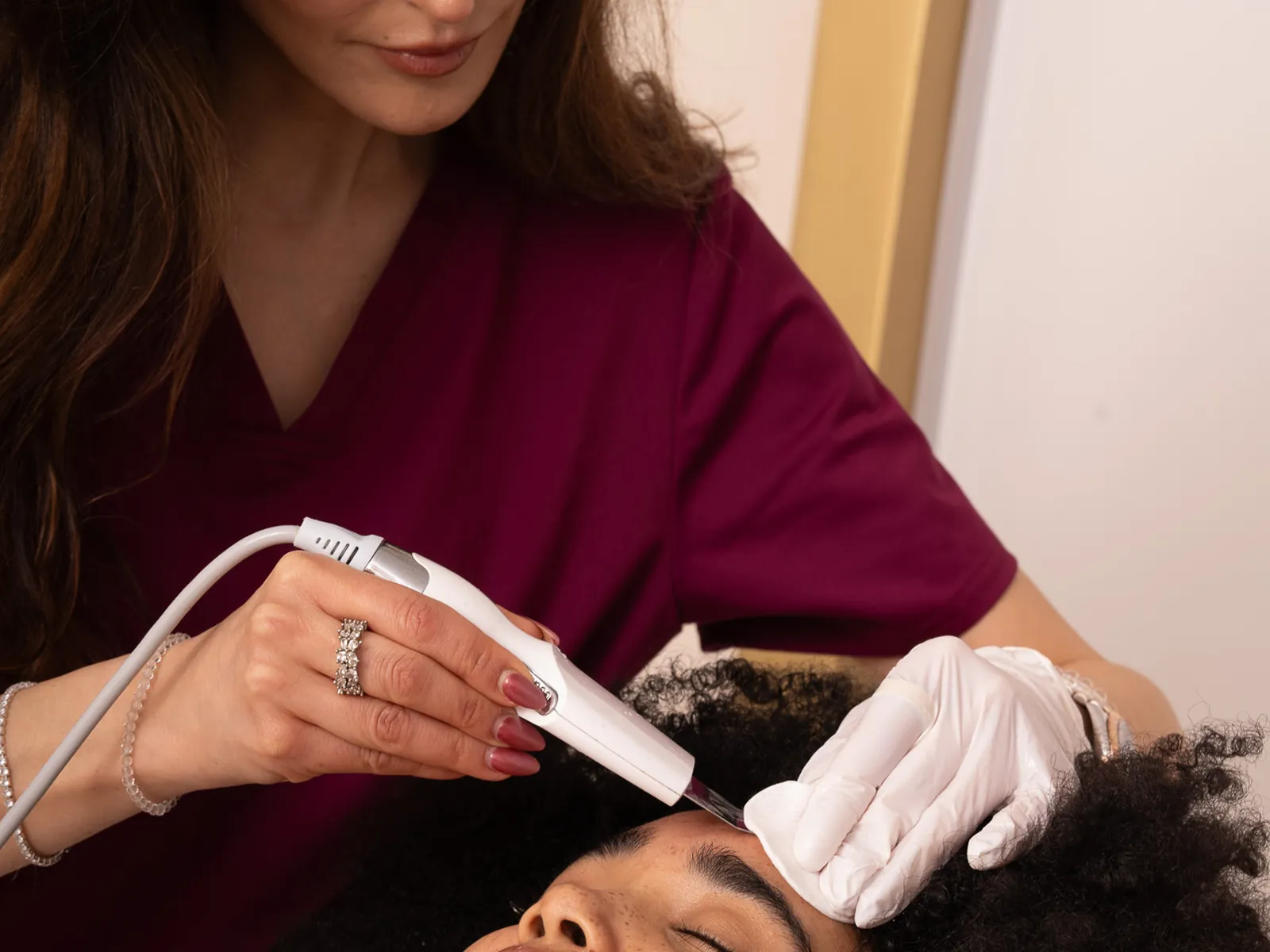 Chemisches Retinol-Peeling treatment